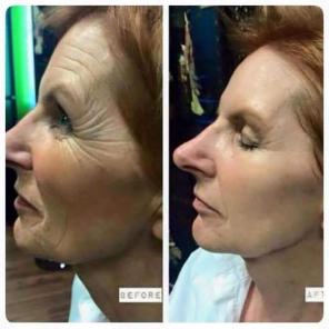  Instantly Ageless