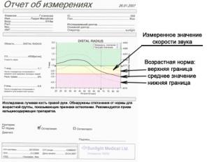   Omnisense 7000